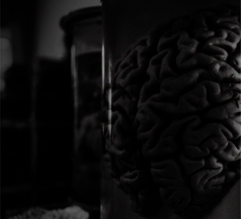 human brain in a jar